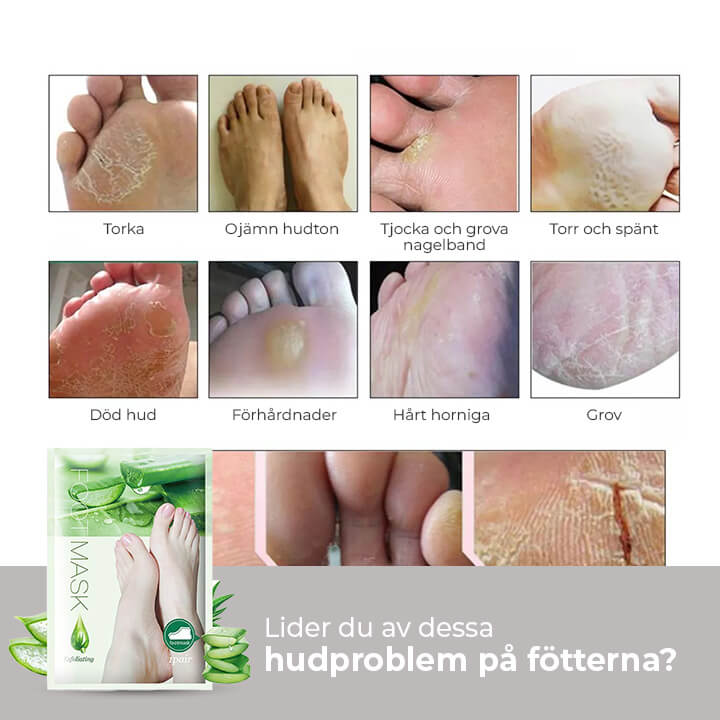 (1+1 GRATIS) Ultimata Foot Peeling-masken